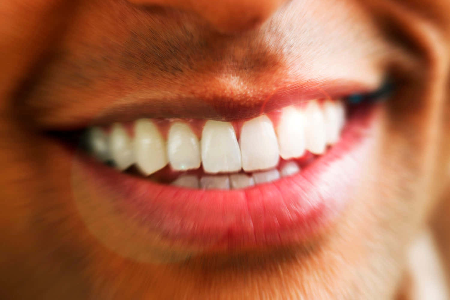 Get The Bright White Smile You Deserve With Teeth Whitening Wallpaper