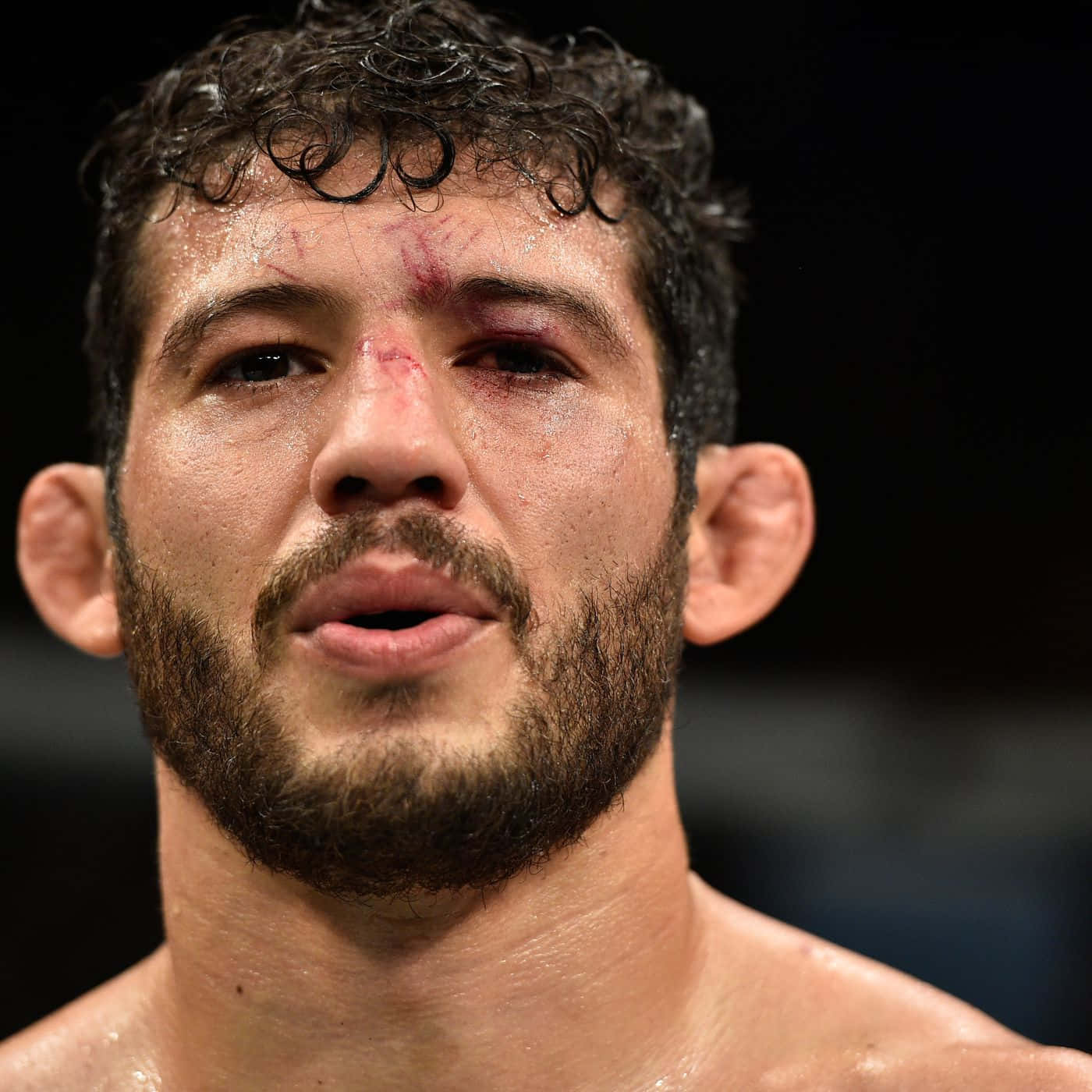 Gilbert Melendez Candid Headshot Left Eye Injury Wallpaper