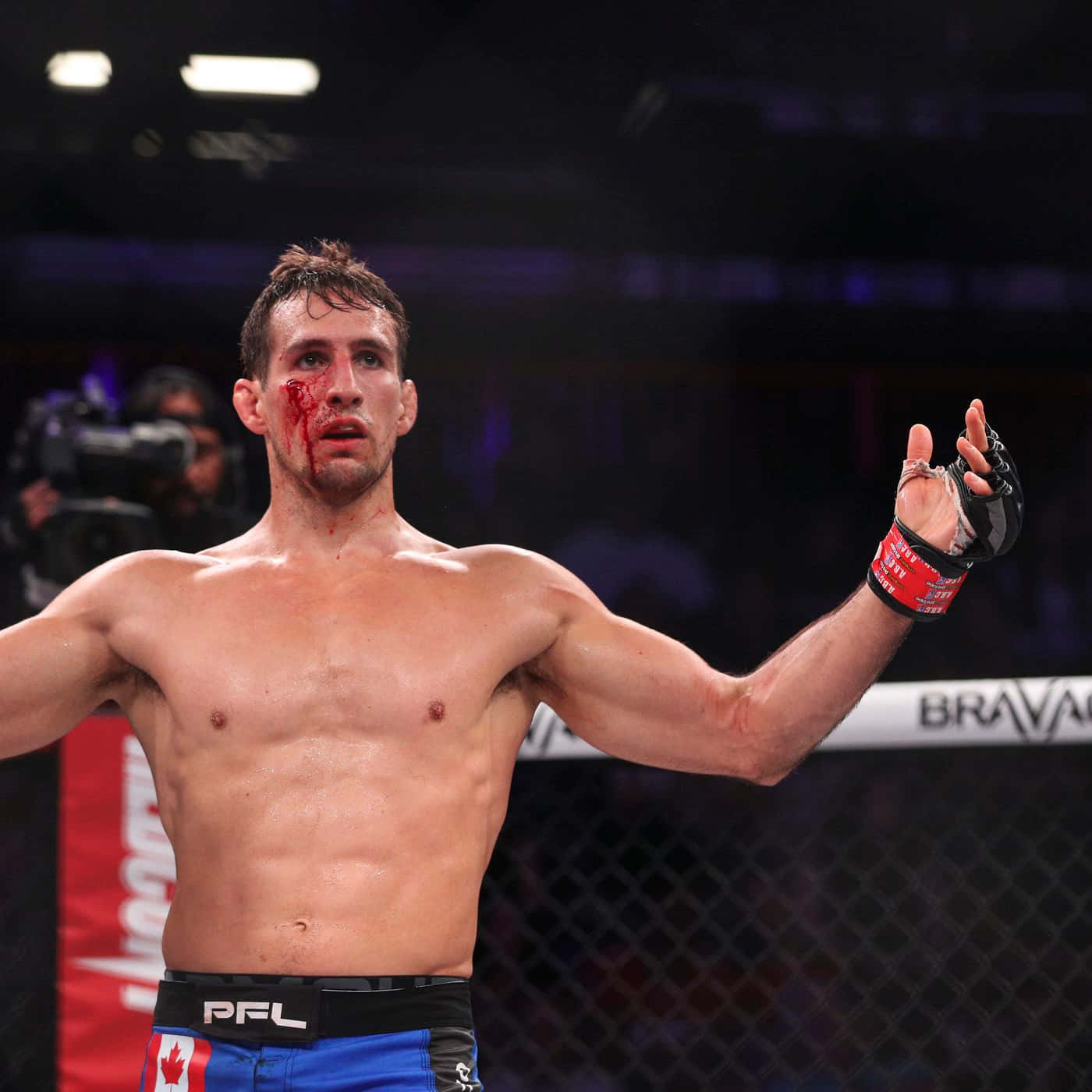 Rory Macdonald Enduring A Fierce Mma Fight Wallpaper