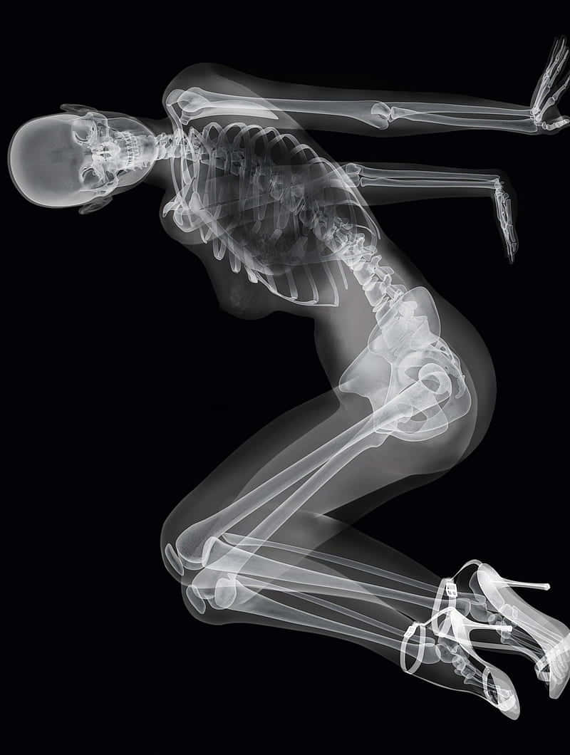 X Ray Of A Skeleton Wallpaper