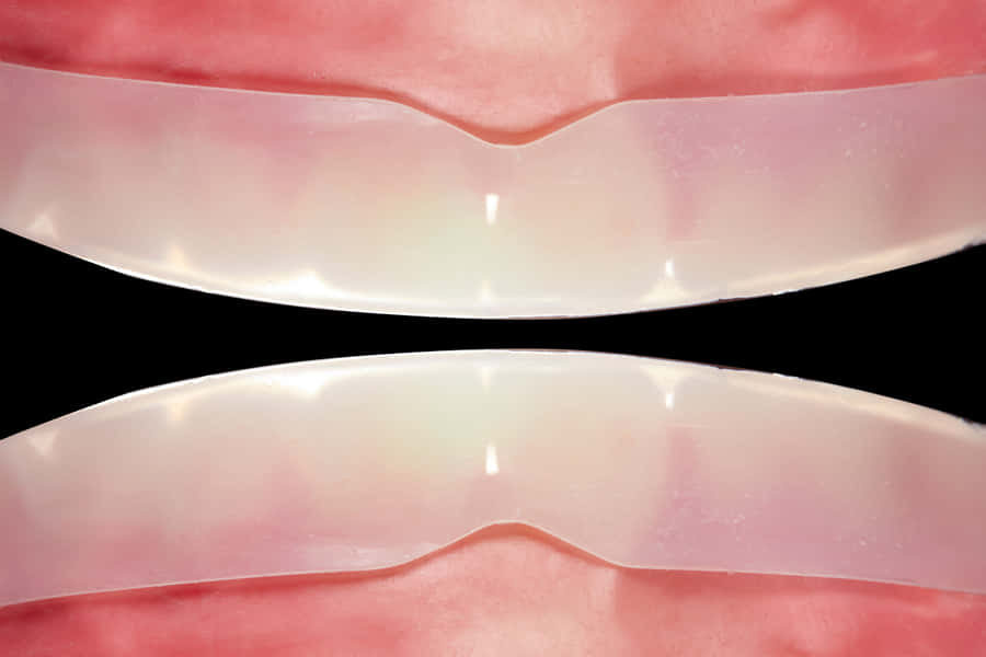 Achieve A Bright, Whiter Smile With Teeth Whitening