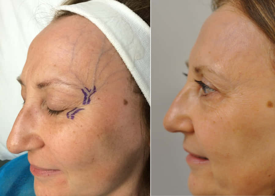 An Intricate Network Of Blue Veins Inspired By Nature Wallpaper