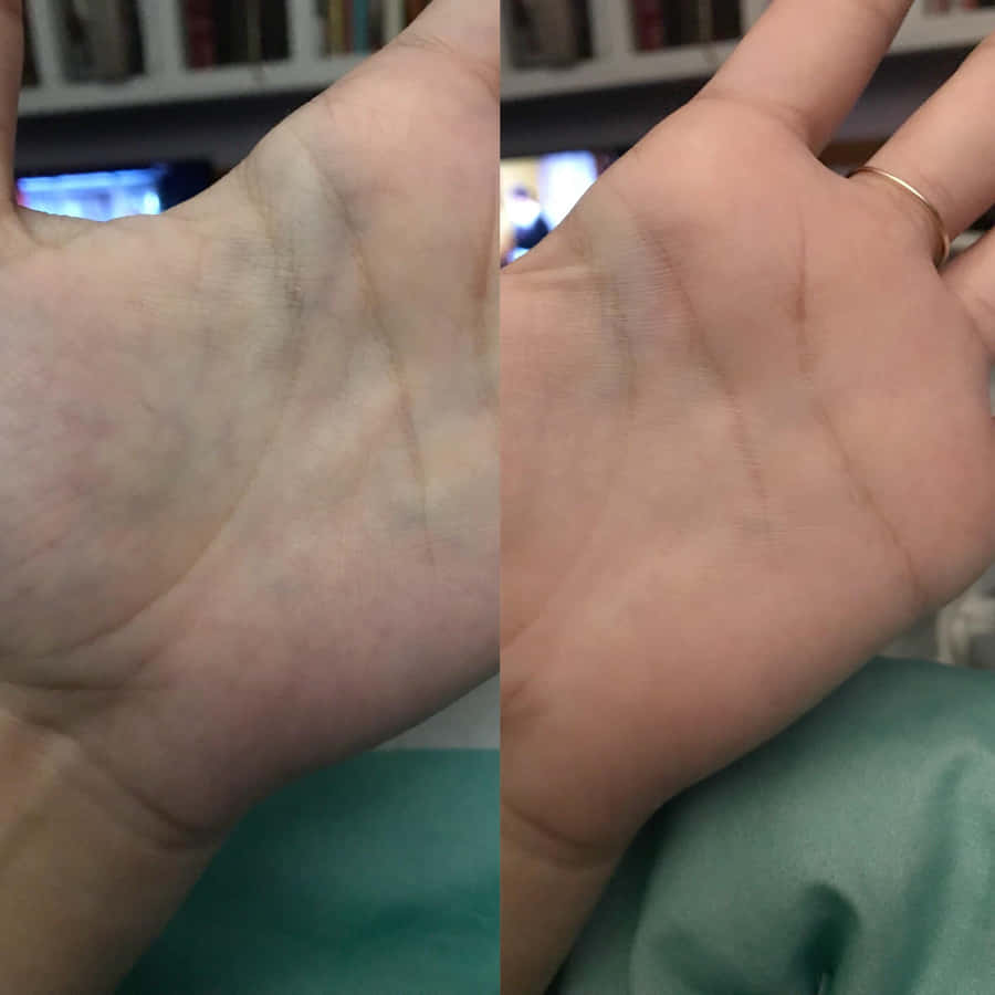 Feel The Rhythm Of Life With Blue Veins! Wallpaper