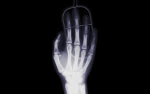 A Closeup X Ray Image Of A Human Hand Wallpaper