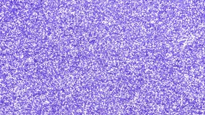 Add A Touch Of Luxurious Sparkle With Purple Glitter Wallpaper