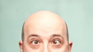 Bald Man With Crossed Eyes Wallpaper