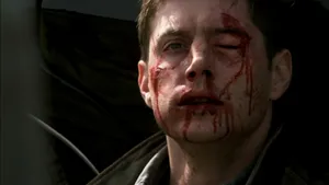 Bruised And Bloody Man Wallpaper