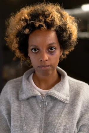 Bruised Woman Staring Ahead Wallpaper