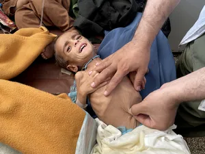 Compassionate Man Comforting An Emaciated Boy Wallpaper