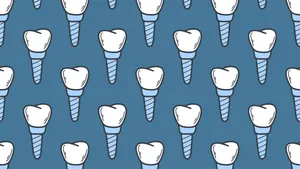 Dental_ Implants_ Pattern_ Background Wallpaper