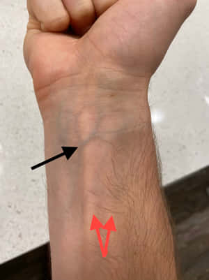 Explore The Mysteries Of Blue Veins Wallpaper