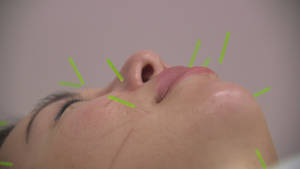 Face Acupuncturist Therapy Wallpaper