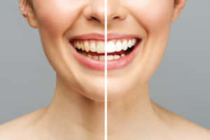 Get The Brightest Smile With Teeth Whitening Wallpaper