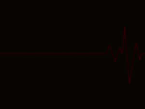 Heart Rate Pulsation On Monitor Screen Wallpaper