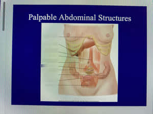 Medical Illustration Of Palpable Abdominal Structures Wallpaper