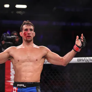 Rory Macdonald Enduring A Fierce Mma Fight Wallpaper