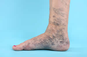 Stunning Close-up Of Blue Veins Texture. Wallpaper