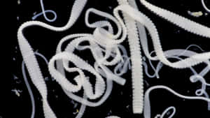 Tapeworm Infestation Closeup Wallpaper