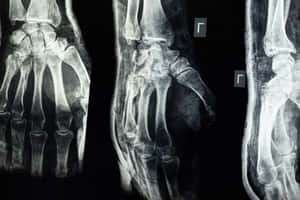 X - Rays Of The Hand And Wrist Wallpaper